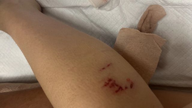 Two dogs attacked Enid's mother and 1-year-old child in the neighborhood