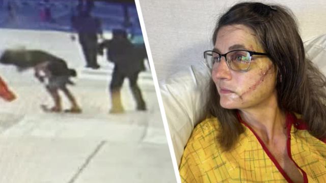 Woman Who Was Hurt in a Brutal Attack in Downtown Dallas Has Memory Problems and Facial Fractures