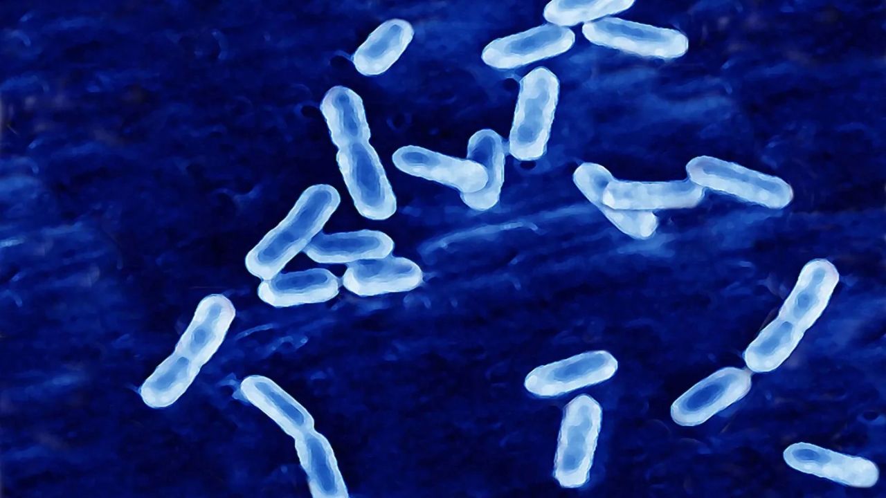 Deadly Listeria Outbreak Linked to Ready-to-Eat Meals Six Dead, 27 Hospitalized Across 18 States
